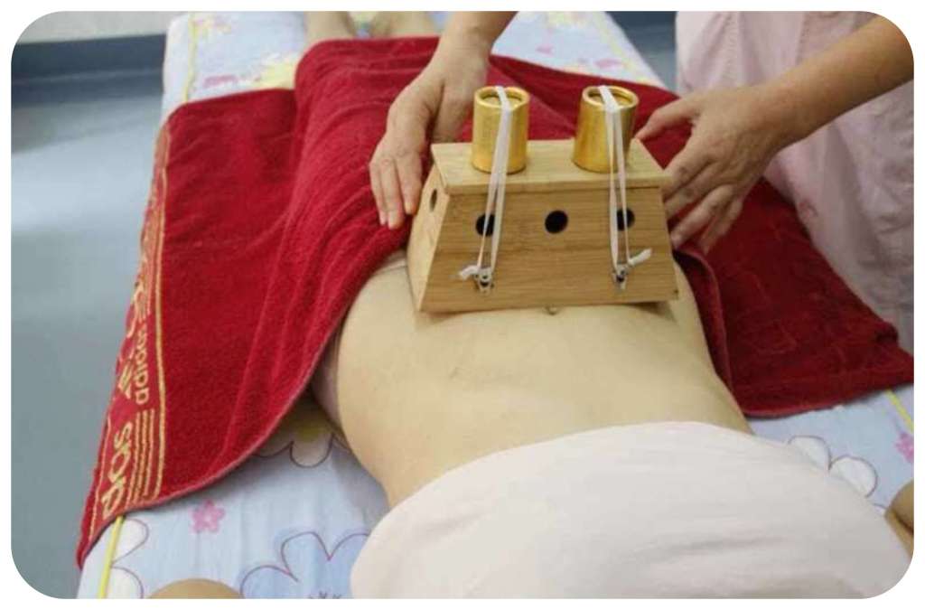 我院妇保科开设"雷火灸"配合手法按摩治疗已经有段时间了,很多患者